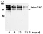 Detection of Recombinant human Adam-TS13 by western blot.