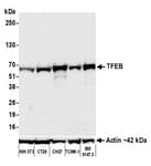 Detection of mouse TFEB by western blot.