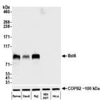 Detection of human Bcl6 by western blot.