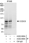 Detection of human CCDC8 by western blot of immunoprecipitates.
