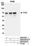 Detection of human TFEB by western blot of immunoprecipitates.