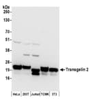 Detection of human and mouse Transgelin 2 by western blot.
