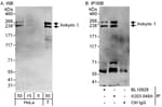 Detection of human Ankyrin 1 by western blot and immunoprecipitation.