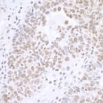 Detection of human BCAS2 by immunohistochemistry.