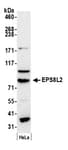 Detection of human EPS8L2 by western blot.