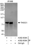 Detection of human THOC1 by western blot of immunoprecipitates.