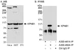 Detection of KPNB1 by western blot and immunoprecipitation.