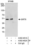Detection of human Sirt6 by western blot of immunoprecipitates.