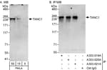 Detection of human TANC1 by western blot and immunoprecipitation.