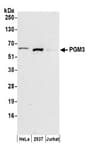 Detection of human PGM3 by western blot.