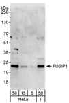 Detection of human FUSIP1 by western blot.