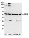 Detection of human and mouse S6K2 by western blot.