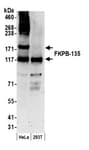 Detection of human FKPB-135 by western blot.