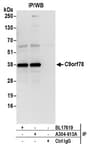 Detection of human C9orf78 by western blot of immunoprecipitates.