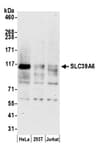 Detection of human SLC39A6 by western blot.