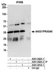 Detection of human AktS1/PRAS40 by western blot of immunoprecipitates.