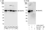 Detection of human and mouse MetAP2 by western blot (h and m) and immunoprecipitation (h).