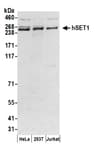 Detection of human hSET1 by western blot.
