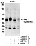 Detection of human Beta-2-Glycoprotein 1 by western blot of immunoprecipitates.
