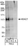 Detection of human HDAC7 by western blot.