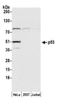 Detection of human p53 by western blot.