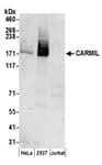 Detection of human CARMIL by western blot.