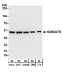 Detection of human and mouse RABGGTB by western blot.