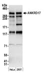 Detection of human ANKRD17 by western blot.