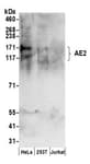 Detection of human AE2 by western blot.
