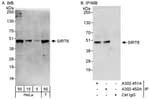 Detection of human Sirt6 by western blot and immunoprecipitation.