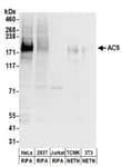 Detection of human and mouse AC9 by western blot.