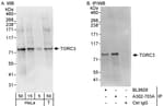 Detection of human TORC3 by western blot and immunoprecipitation.