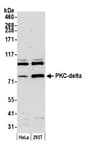 Detection of human PKC-delta by western blot.