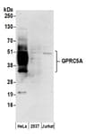 Detection of human GPRC5A by western blot.
