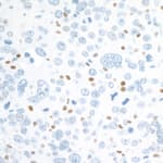 Detection of mouse c-MAF by immunohistochemistry.