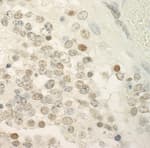 Detection of mouse PRCC by immunohistochemistry.