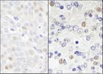 Detection of human and mouse DDX46 by immunohistochemistry.