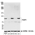 Detection of mouse FOXP1 by western blot.