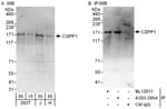 Detection of human CSPP1 by western blot and immunoprecipitation.