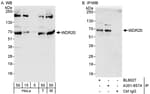 Detection of human and mouse WDR20 by western blot (h&amp;m) and immunoprecipitation (h).