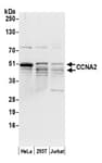 Detection of human CCNA2 by western blot.