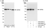 Detection of human HSP60 by western blot and immunoprecipitation.