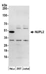 Detection of human NUPL2 by western blot.