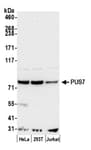 Detection of human PUS7 by western blot.