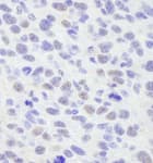 Detection of mouse SMAR1/BANP by immunohistochemistry.