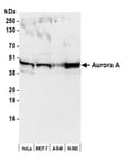 Detection of human Aurora A by western blot.