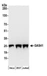Detection of human GAS41 by western blot.