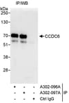 Detection of human CCDC6 by western blot of immunoprecipitates.