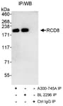 Detection of human RCD8 by western blot of immunoprecipitates.