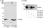 Detection of human and mouse REA by western blot (h &amp; m) and immunoprecipitation (h).